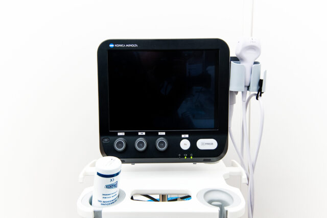 超音波エコー診断装置